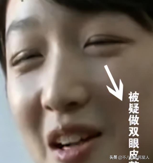 割了双眼皮就判若两人,这6位明星动脸太成功了