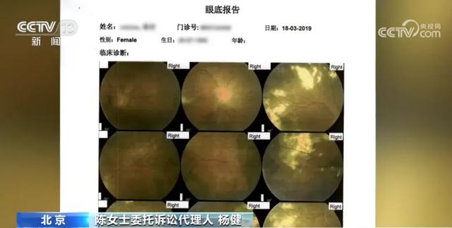 美容院注射玻尿酸后,女子近乎失明!法院判了