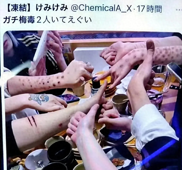 日本年轻人怎么了?以得梅毒为傲,感染人数刷新历史