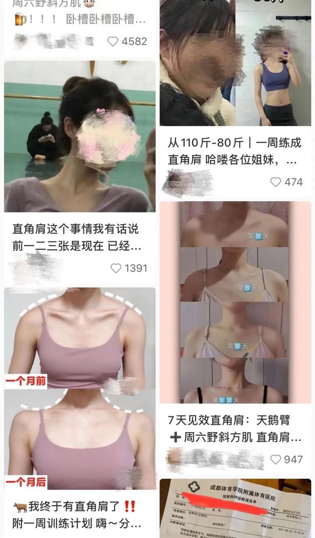 赶紧停下!火爆全网的这种身材,华西医生说:一不小心就让你受伤