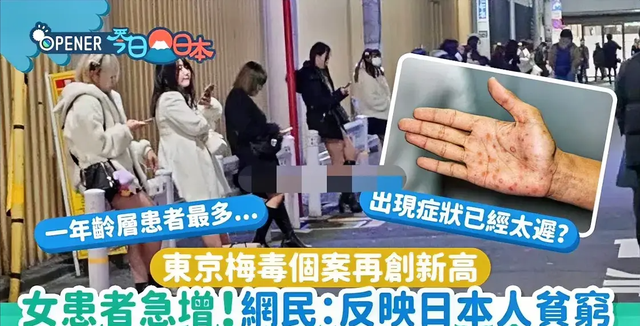 日本年轻人怎么了?以得梅毒为傲,感染人数刷新历史