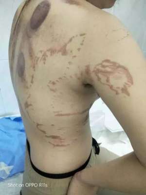 紫涵美女主播(“女主播”拔罐时后背突然起火，涉事美发店员竟是自学技术)