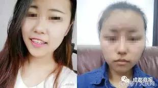 整容后就能成为主播！研究生接到星探电话，整容后却发现……