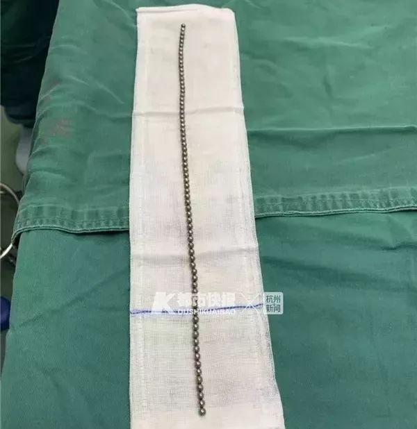 丁丁里塞进了70颗钢珠!家长们都该了解一下“儿童自慰”……