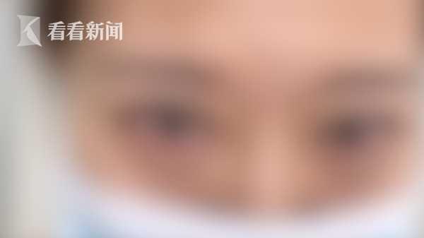 熟人介绍贷款6万多整容 女主播却被整成了这样
