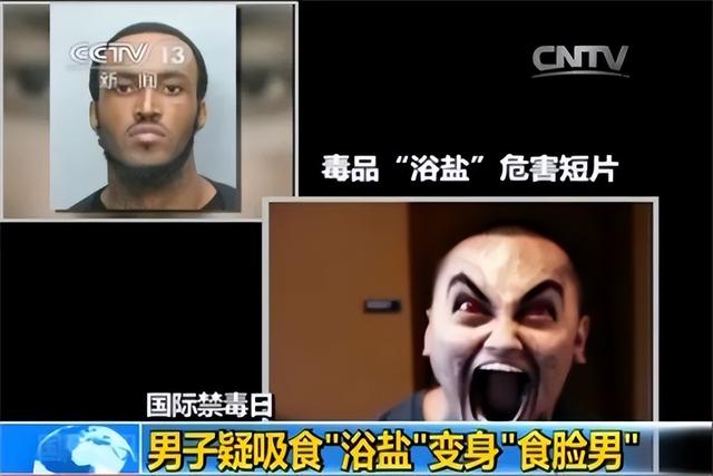 “丫丫”到底怎么了?骨瘦如柴、毛发脱落 → 网友:像吸毒了一样!