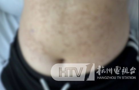 年轻女主播崩溃!全身脱皮、奇痒不止!只因24小时都在…紧急提醒