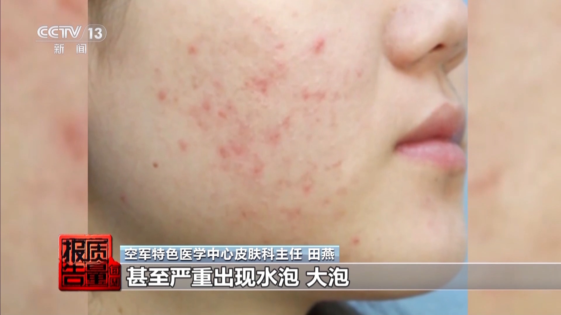 揭开防晒化妆品的“迷雾” “防护”还是“防晒”？